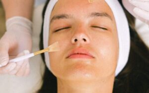 Understanding the Different Types of Chemical Peels